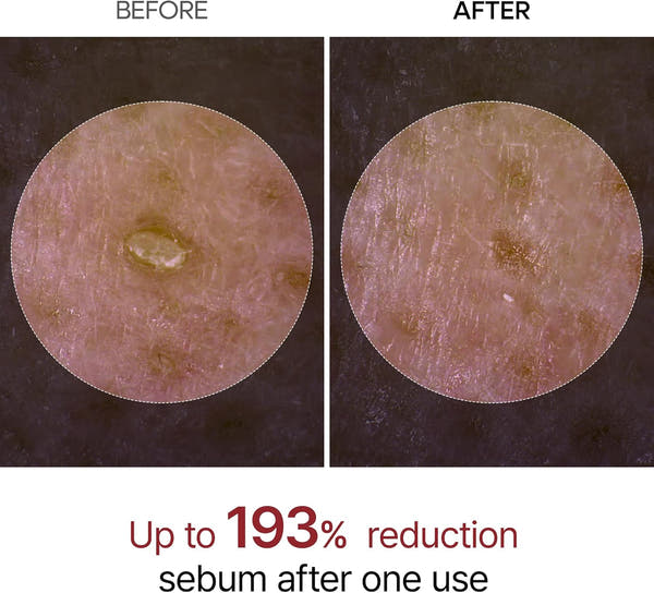 Dr.Melaxin Glow Rice Peeling Pack