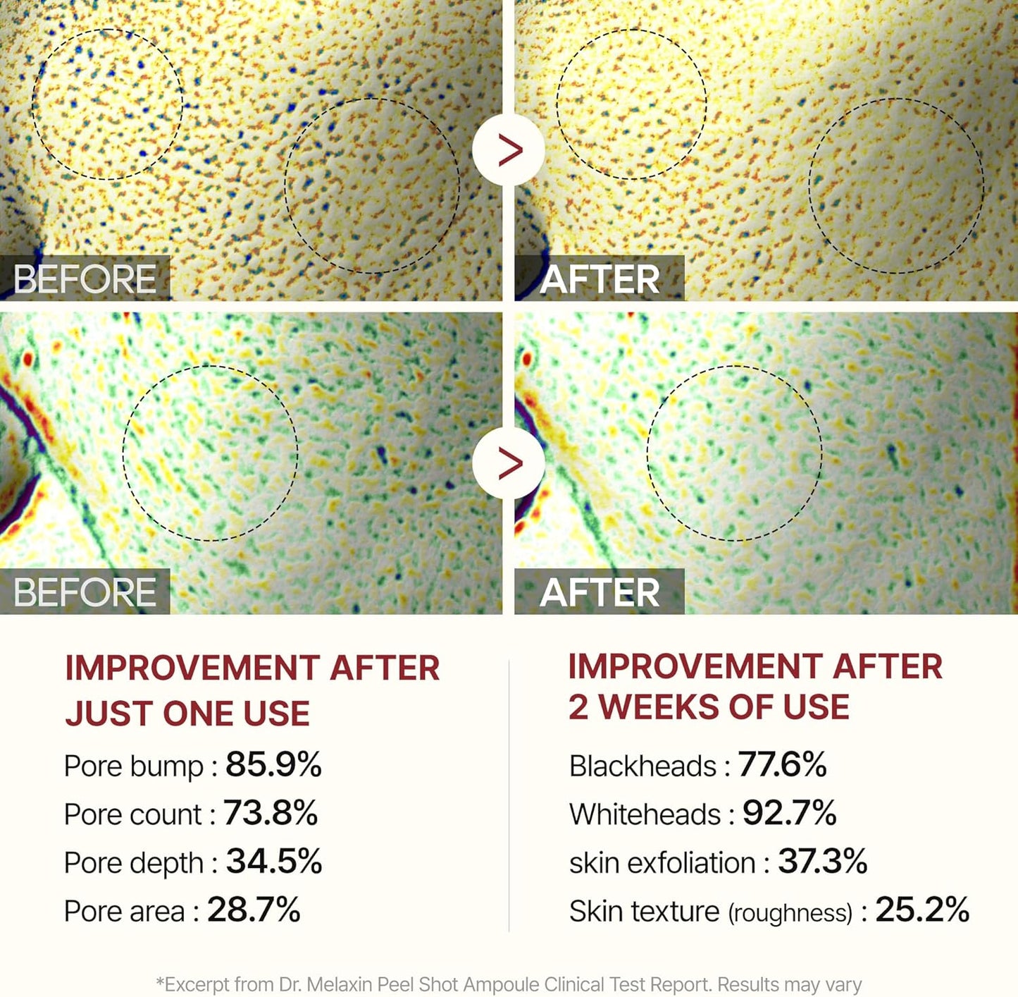 Dr.Melaxin Glow Rice Peeling Pack
